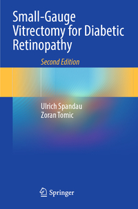 Small-Gauge Vitrectomy for Diabetic Retinopathy