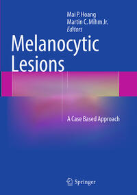 Melanocytic Lesions