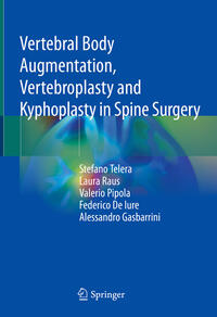 Vertebral Body Augmentation, Vertebroplasty and Kyphoplasty in Spine Surgery