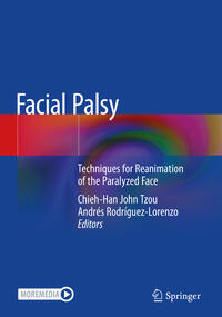 Facial Palsy