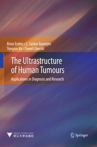 The Ultrastructure of Human Tumours