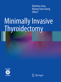 Minimally Invasive Thyroidectomy