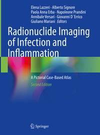 Radionuclide Imaging of Infection and Inflammation