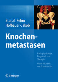 Knochenmetastasen