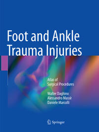 Foot and Ankle Trauma Injuries