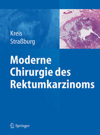 Moderne Chirurgie des Rektumkarzinoms