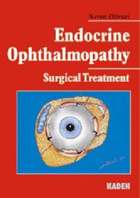 Endocrine Ophthalmopathy