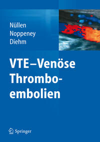 VTE - Venöse Thromboembolien