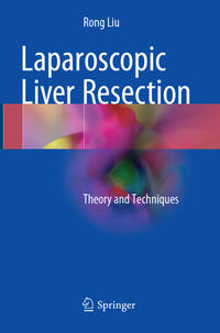 Laparoscopic Liver Resection