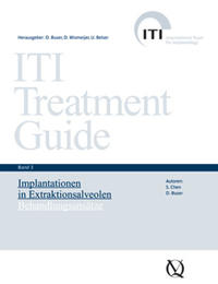 Implantationen in Extraktionsalveolen