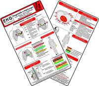 EKG Diagnostik & Ableitungen 2025 - Medizinische Taschen-Karte