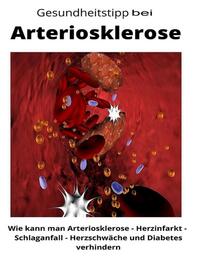 Gesundheitstipp bei Arteriosklerose