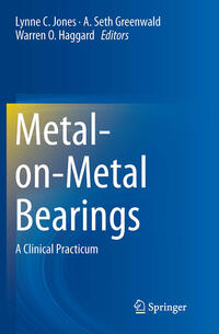 Metal-on-Metal Bearings