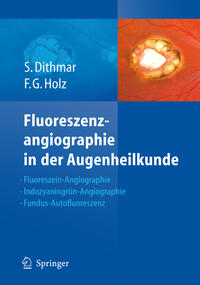 Fluoreszenzangiographie in der Augenheilkunde