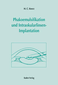 Phakoemulsifikation und Intraokularlinsen-Implantation