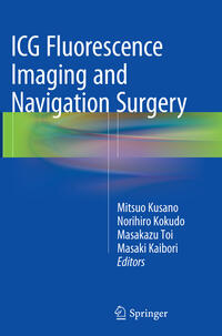 ICG Fluorescence Imaging and Navigation Surgery