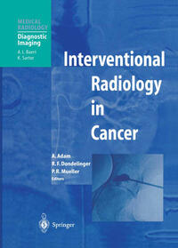 Vorderes Coverbild Interventional Radiology in Cancer