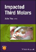 Impacted Third Molars