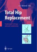 Total Hip Replacement