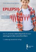 Epilepsie