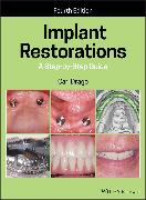 Implant Restorations