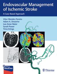 Vorderes Coverbild Endovascular Management of Ischemic Stroke