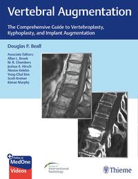 Vorderes Coverbild Vertebral Augmentation