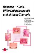 Rosazea – Klinik, Differentialdiagnostik und aktuelle Therapie