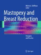 Mastopexy and Breast Reduction