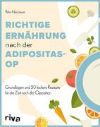 Richtige Ernährung nach der Adipositas-OP