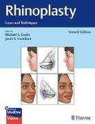 Rhinoplasty