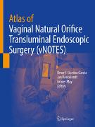 Atlas of Vaginal Natural Orifice Transluminal Endoscopic Surgery (vNOTES)